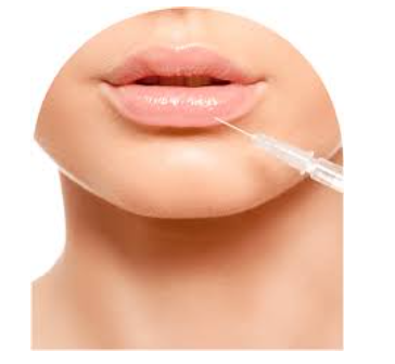 Purchasing dermal fillers